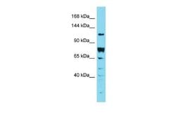 DENND2A Rabbit anti-Human, Polyclonal, Novus Biologicals 100 &mu;g | Buy Online | Novus Biologicals | Fisher Scientific